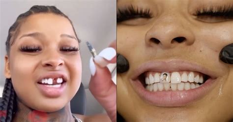 chrisean rock missing tooth|Chrisean Rock Finally Visits Dentist To Fix Her Missing Tooth!